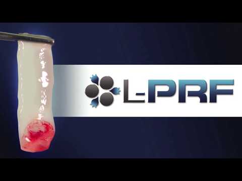 A glass of liquid next to the l-prin logo.
