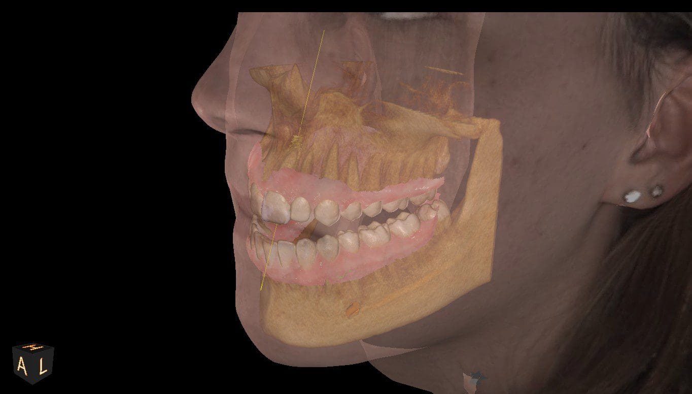 A picture of an x-ray image of the mouth and teeth.